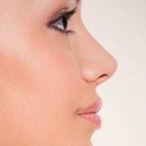 Ринопластика кончика носа