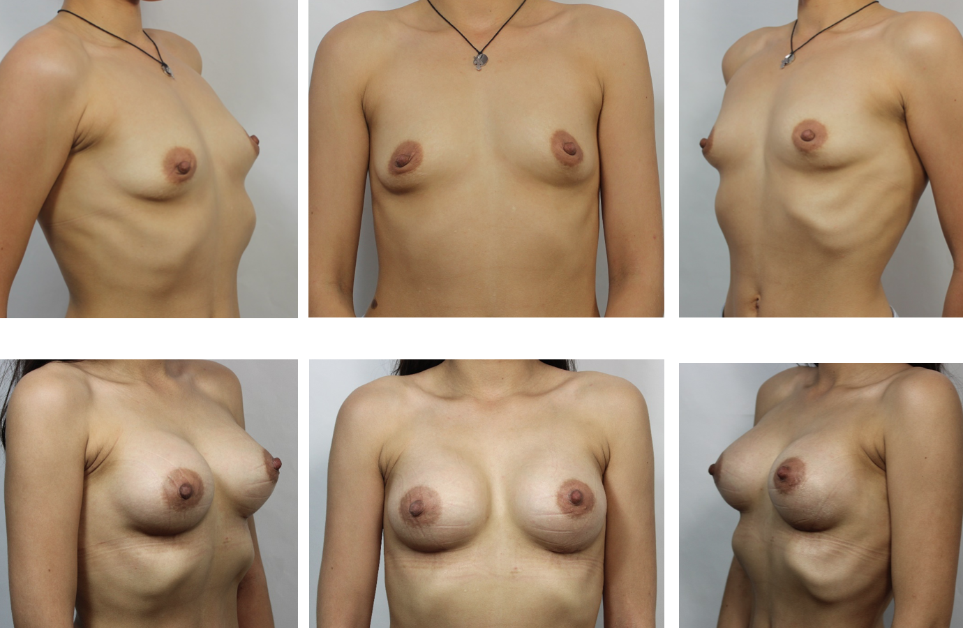 виды груди разных женщин фото 62
