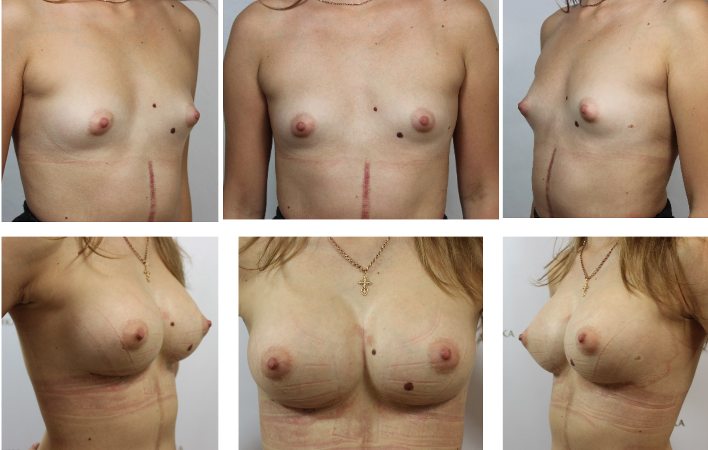 размеры груди и сосков у женщин фото 18