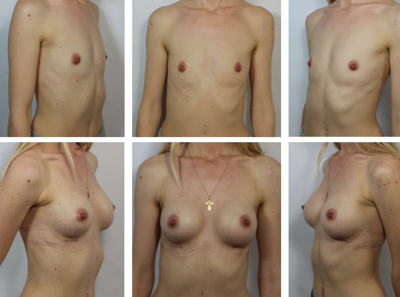 форум женской груди фото 50