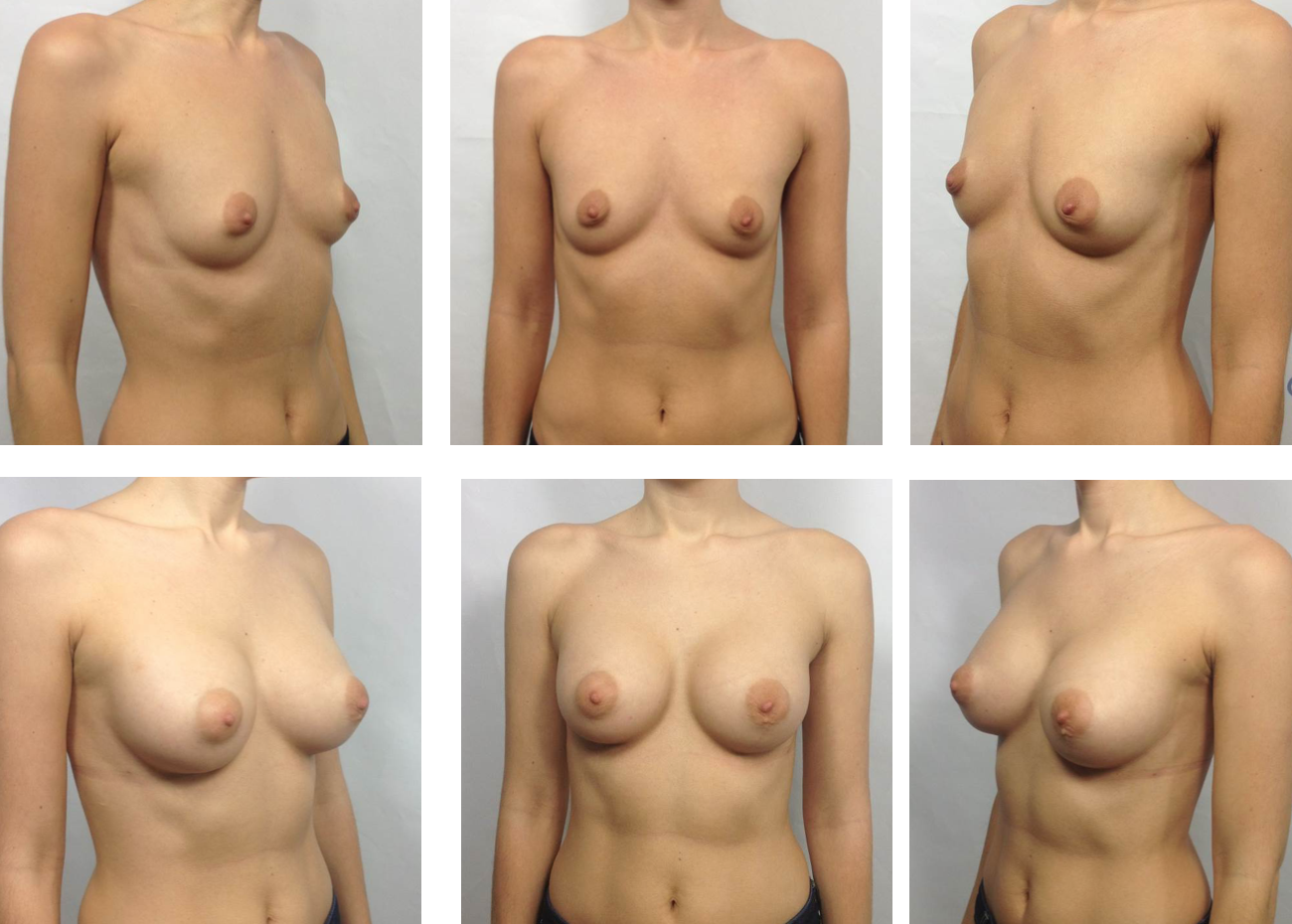 бывают у женщин разные груди фото 105