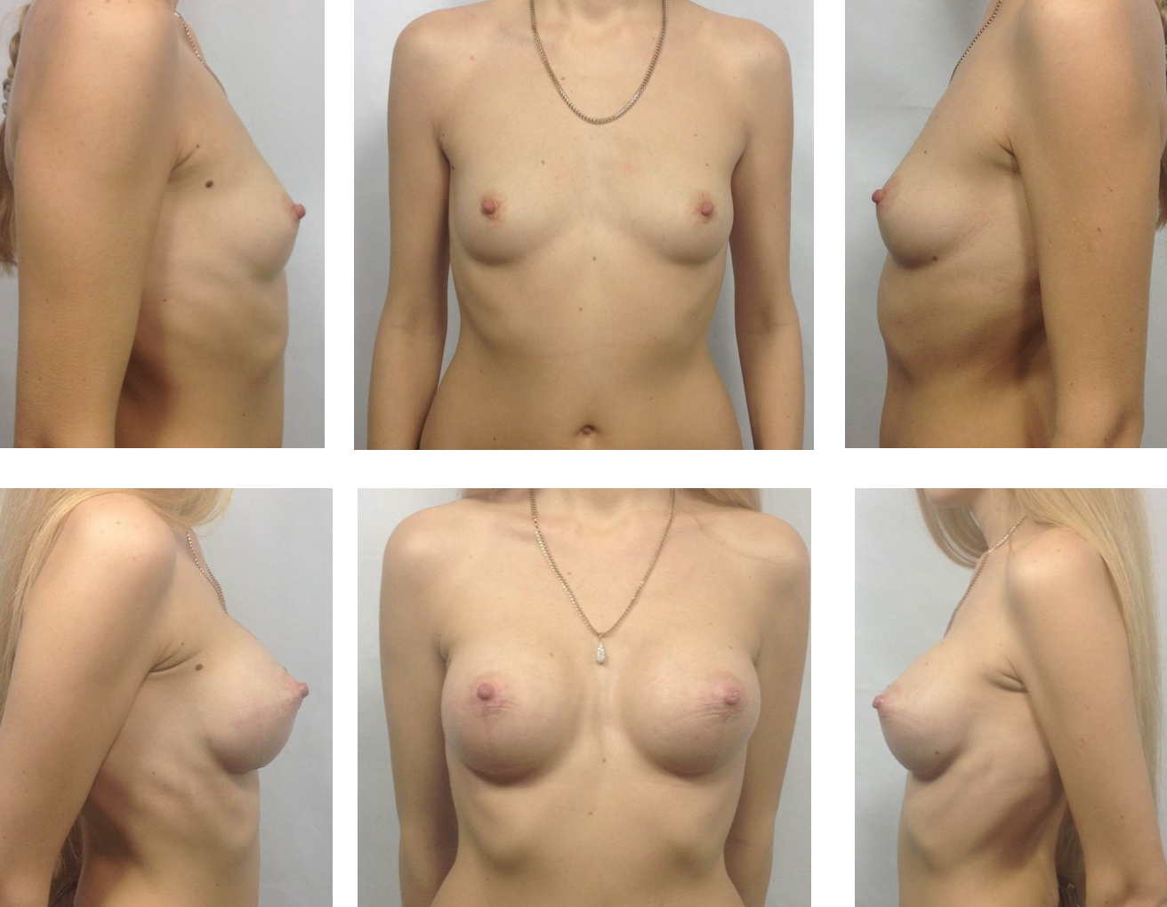 что отвечает за рост груди у женщин фото 76