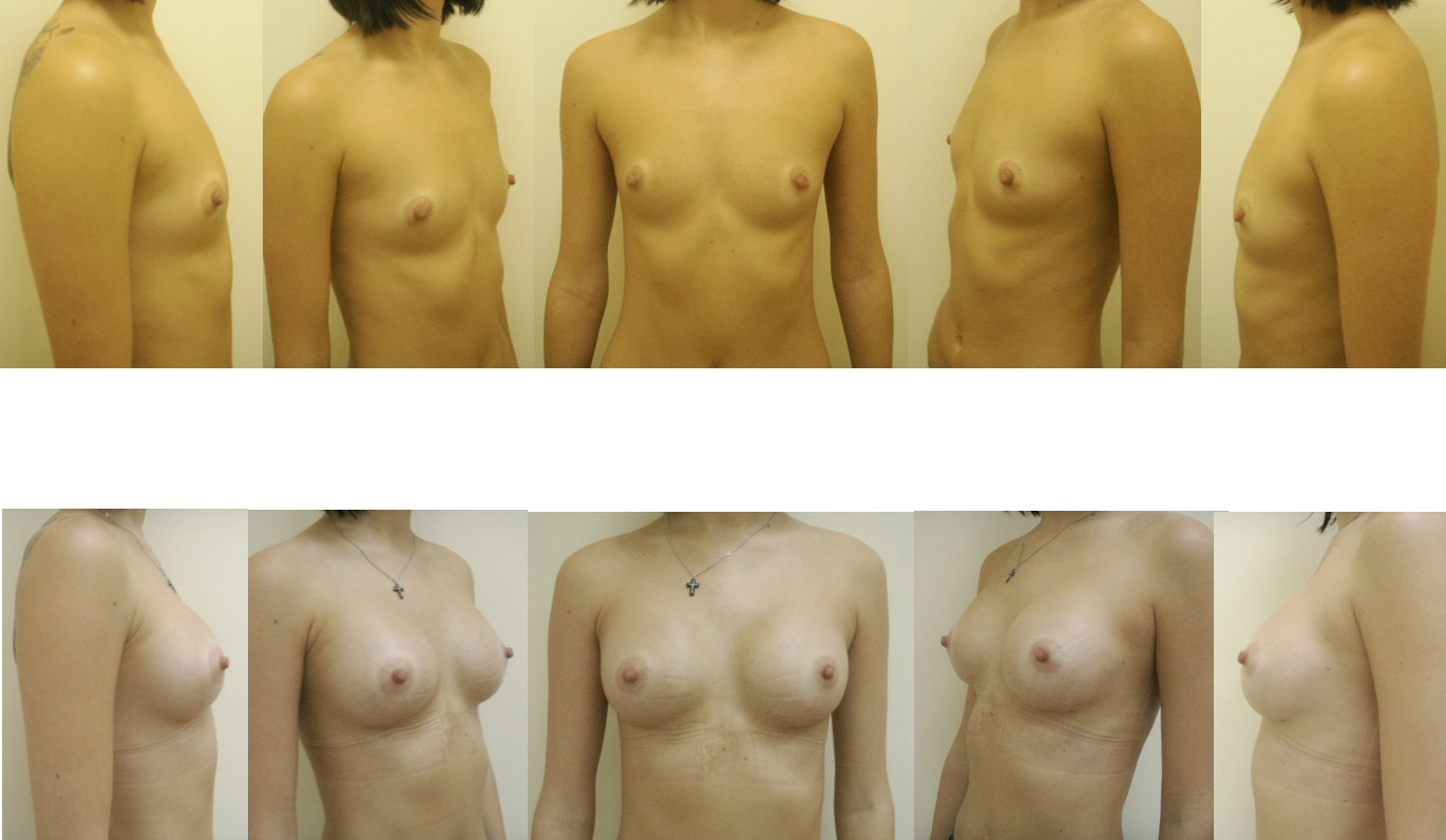 форумы о размере женской груди фото 47