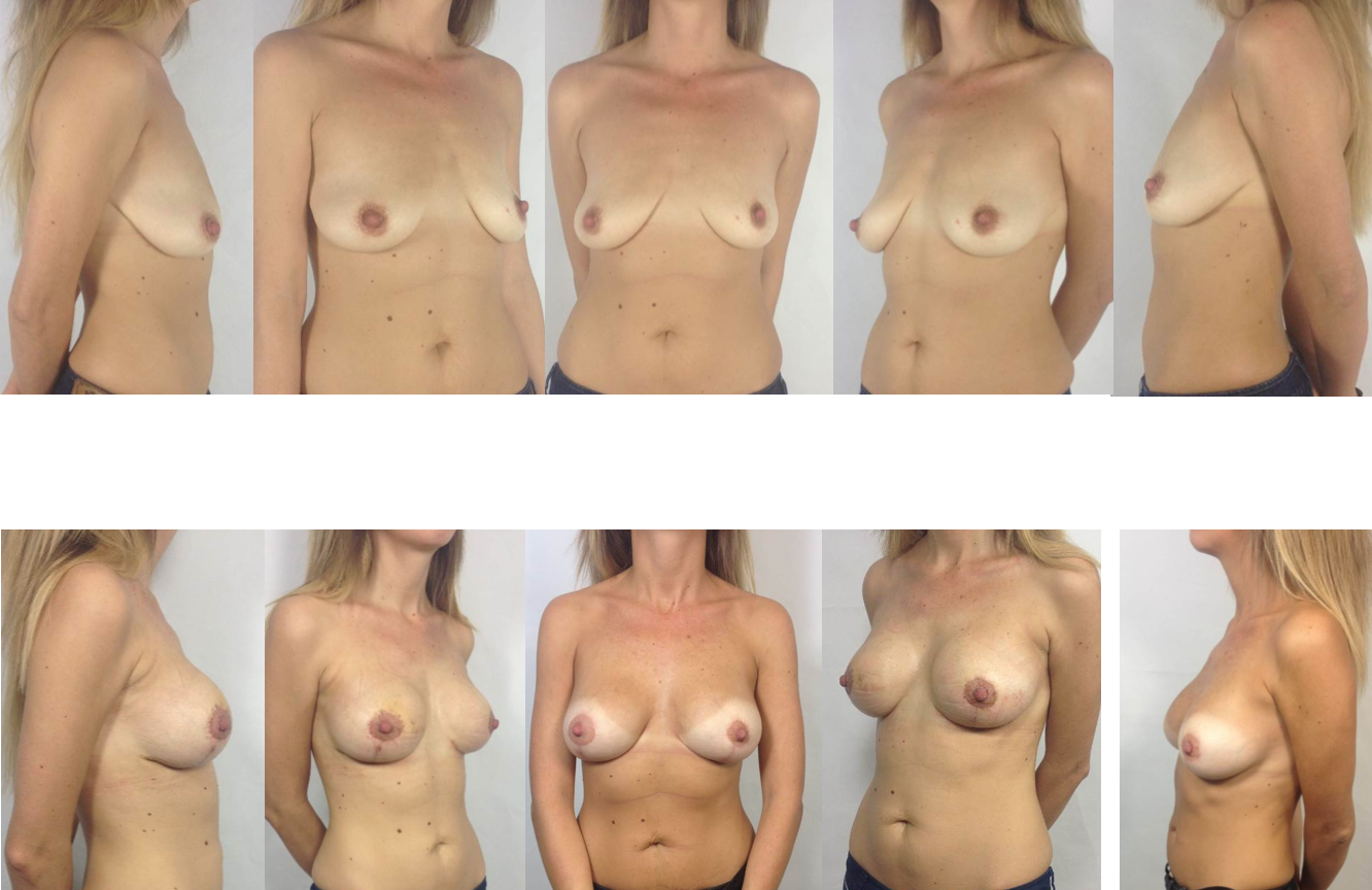 размеры груди 45 летних женщин фото 8