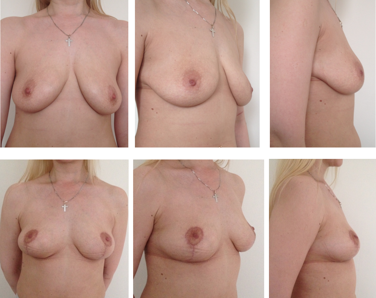 увеличилась одна грудь во время менструации фото 35